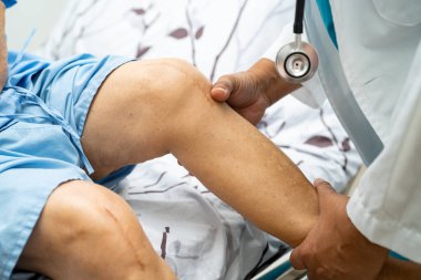 Asyalı yaşlı ya da yaşlı kadın hasta yaralarını gösteriyor. Diz eklemi ameliyatıyla değiştirilmiş. Hemşirelik hastanesi koğuşunda yatağında eklem iltihabı var..