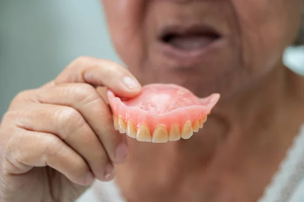 Asiatische Seniorin Oder Ältere Patientin Die Eine Prothese Auf Der — Stockfoto