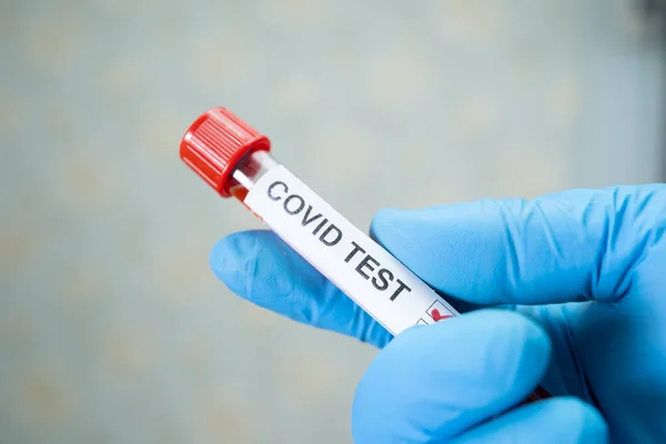 Échantillon Positif Infection Sanguine Dans Une Éprouvette Pour Coronavirus Covid — Photo