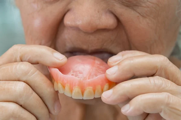 Asyalı Yaşlı Yaşlı Hasta Hemşire Hastanesi Koğuşunda Takma Diş Takmak — Stok fotoğraf