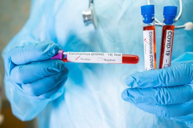 Laboratuvarda kovid 19 koronavirüs için test tüpünde pozitif kan enfeksiyonu örneği bulundu. Hastanedeki hastayı kontrol etmek ve analiz etmek için bekleyen bir bilim adamı.