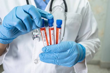Laboratuvarda kovid 19 koronavirüs için test tüpünde pozitif kan enfeksiyonu örneği bulundu. Hastanedeki hastayı kontrol etmek ve analiz etmek için bekleyen bir bilim adamı.