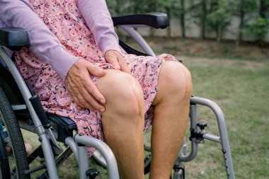 Asyalı yaşlı ya da yaşlı kadın hasta yaralarını gösteriyor. Diz eklemi ameliyatıyla değiştirilmiş. Hemşirelik hastanesi koğuşunda yatağında eklem iltihabı var..