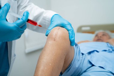 Asyalı doktor, Hyaluronic asit trombosit enjekte ederek yaşlı kadının dizine zengin plazma enjekte etti..