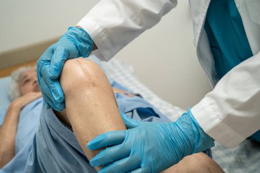 Asyalı yaşlı ya da yaşlı kadın hasta yaralarını gösteriyor. Diz eklemi ameliyatıyla değiştirilmiş. Hemşirelik hastanesi koğuşunda yatağında eklem iltihabı var..