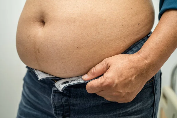 Overweight Asian woman show fat belly at office.