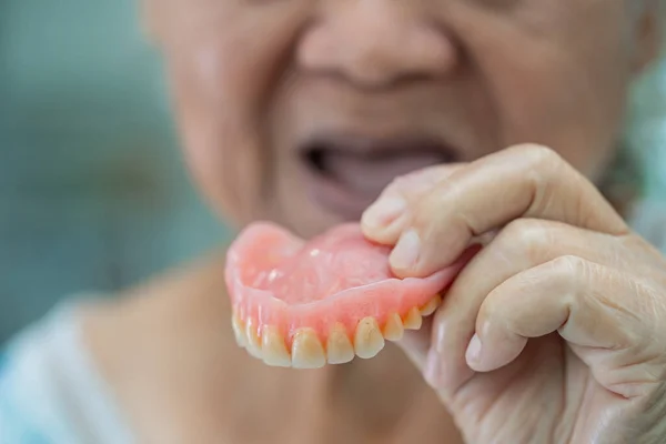 Asiática Senior Anciana Anciana Paciente Sosteniendo Usar Dentadura Postiza Enfermería — Foto de Stock