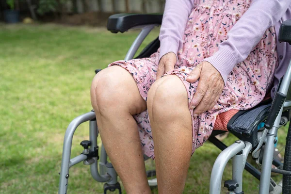 Ázsiai Idős Vagy Idős Hölgy Beteg Mutatják Hegek Sebészeti Teljes — Stock Fotó