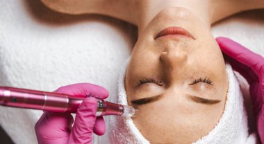 Close-up portrait of cosmetologist beauticians hands doing mesotherapy with dermapen. Microneedle facial procedure. Professional cosmetology.
