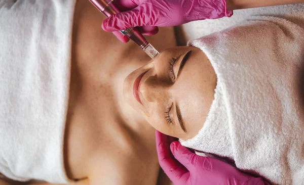 Woman Getting Facial Dermapen Treatment Spa Salon Beauty Concept Face — Stock Photo, Image