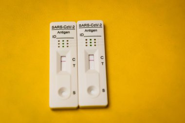RIGA, LATVIA. 9 Ocak 2021. Negatif SARS-CoV-2 Karınca Testi.