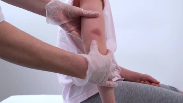 医者は子供の肘を麻痺させる。外傷学者は傷害の場所を検査する。子供たちの腕にあざがあります。肘の怪我 — ストック動画