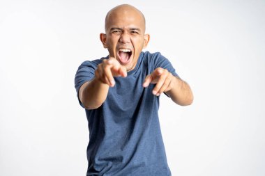 Kel adam parmaklarını göstererek gülerken ağzını kocaman açar.