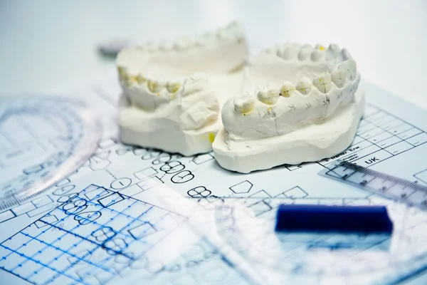 Orthodontische mallen — Stockfoto
