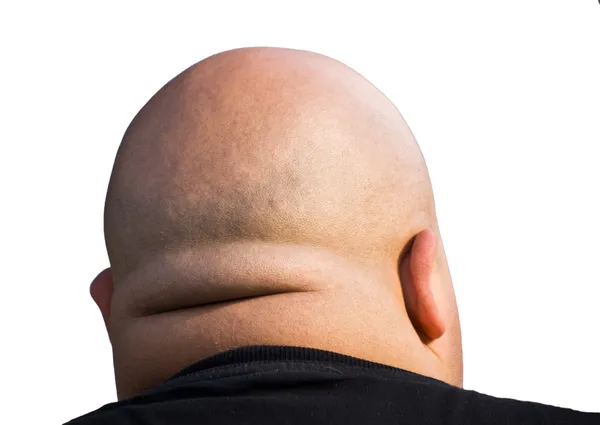 Bald head isolated — Stock Photo, Image