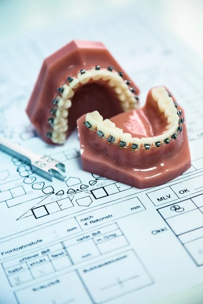 Utensili ortodontici — Foto Stock