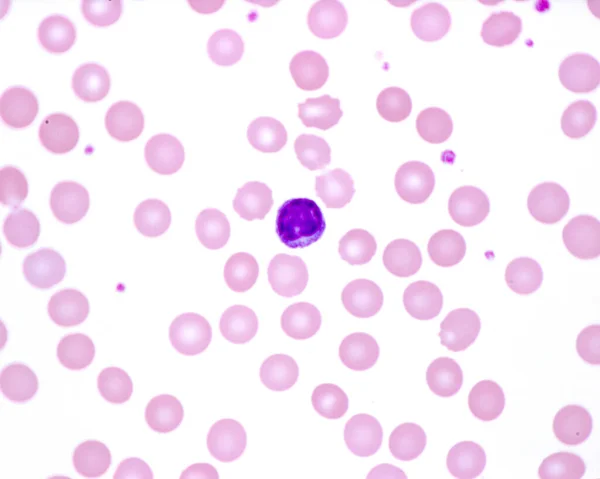 Human Blood Smear Lymphocyte Observed Small Bluish Dots Red Blood — Stock Photo, Image