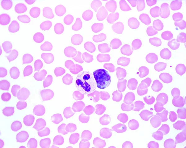 ヒトの血液は好中球 と単球 を示す 赤血球の間の小さな青い点は血小板です — ストック写真