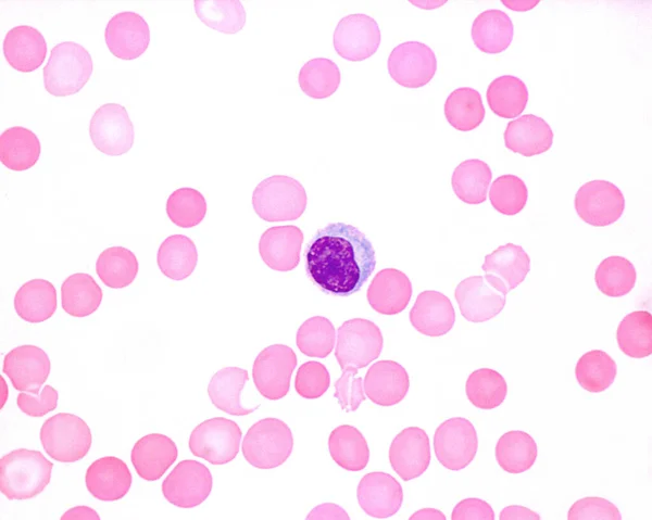 Monocito Frotis Sangre Humana —  Fotos de Stock