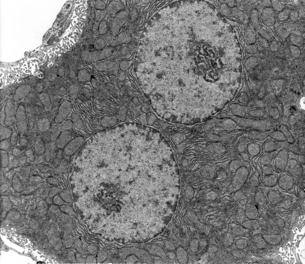 Tem Mikrograf Ukazující Binukleární Hepatocyt Cytoplazma Vykazuje Mnoho Mitochondrií Protáhlých — Stock fotografie
