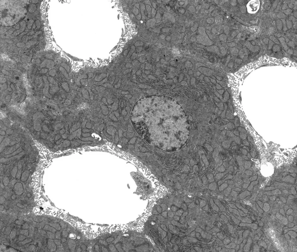 Tem Micrograph Showing Hepatocyte Plates Located Three Sinusoids Hepatocyte Cytoplasm — 스톡 사진