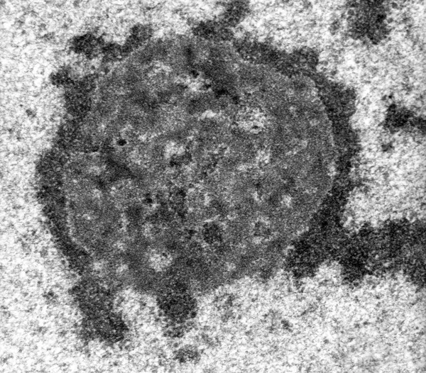 肝細胞の核の高倍率Temマイクログラフは 高密度の繊毛成分と粒状成分を示しています 核は黒核関連クロマチンに囲まれています — ストック写真