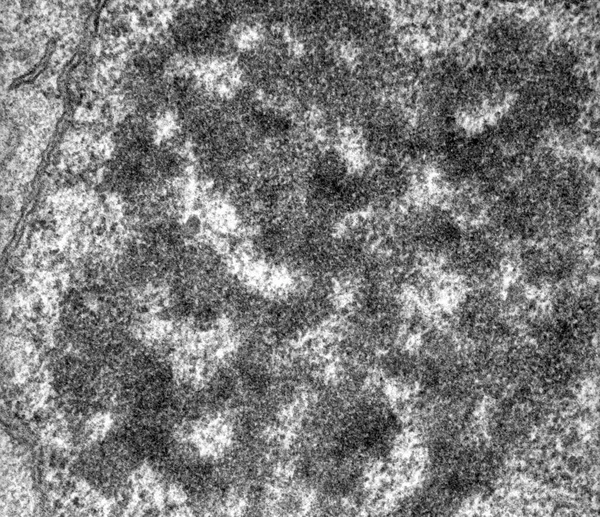 Micrografo Tem Alto Ingrandimento Del Nucleolo Epatocita Che Mostra Densa — Foto Stock