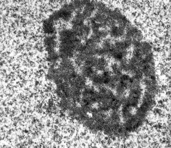 Высокое увеличение TEM микрографа ядра гепатоцита, показывающего плотный фибриллярный компонент и гранулярный компонент.