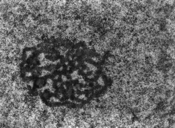 Высокое увеличение TEM микрографа ядра гепатоцита, показывающего плотный фибриллярный компонент и гранулярный компонент.