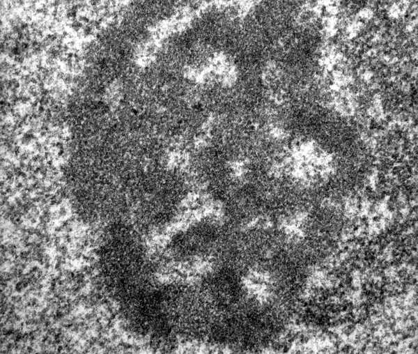 High Magnification Tem Micrograph Nucleolus Hepatocyte Showing Dense Fibrillar Component — ストック写真