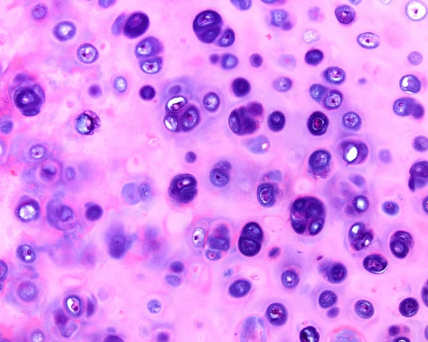 Onafhankelijke Groepen Cellen Van Hyalinekraakbeenweefsel Chondrocyten Ondergaan Mitose Een Isogene — Stockfoto