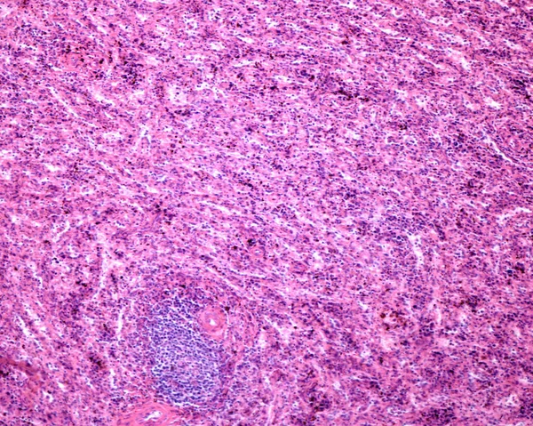 脾脏实质大多为红髓 由脾脏窦和扁桃体的线缆组成 显示巨噬细胞含有铁质色素 在底部 一个动脉周围淋巴鞘是白髓的一个组成部分 — 图库照片
