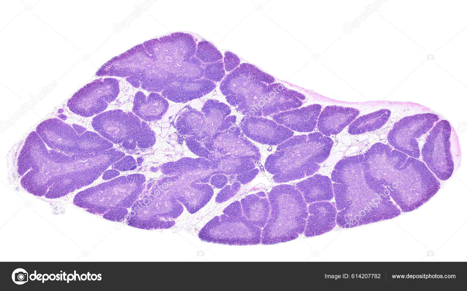 Low Power Light Microscope Micrograph Human Thymus Gland Stained Thymic