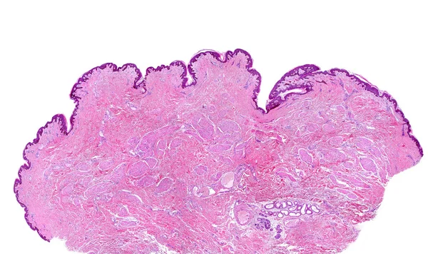 ヒト乳房乳首の低出力顕微鏡顕微鏡顕微鏡顕微鏡 それは色素性の薄い肌で覆われています 結合組織には平滑筋繊維 乳首の勃起 の多くのファクトリーがあります 下には２つの汗腺アポクリンがあります — ストック写真