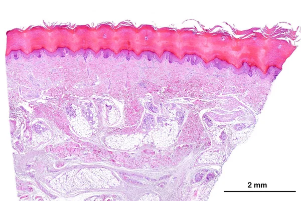 人体无毛皮肤的低功率光学显微镜 从上面看 角化的鳞状上皮 表现出明显的角质层 真皮和皮下组织 真皮下部是通过脂肪的存在来鉴别的 — 图库照片
