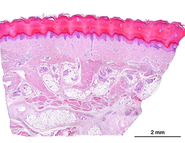 人体无毛皮肤的低功率光学显微镜 从上面看 角化的鳞状上皮 表现出明显的角质层 真皮和皮下组织 真皮下部是通过脂肪的存在来鉴别的 — 图库照片