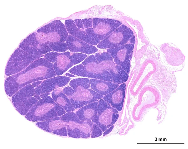 현미경으로 흉선을 있습니다 소립자로 이루어진 조직은 수있다 Lobule 피질은 Lymphocyte — 스톡 사진