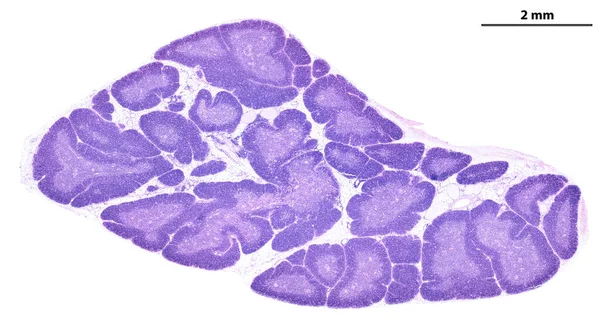 Micrograaf Met Lage Lichtsterkte Van Een Menselijke Thymusklier Bevlekt Met — Stockfoto