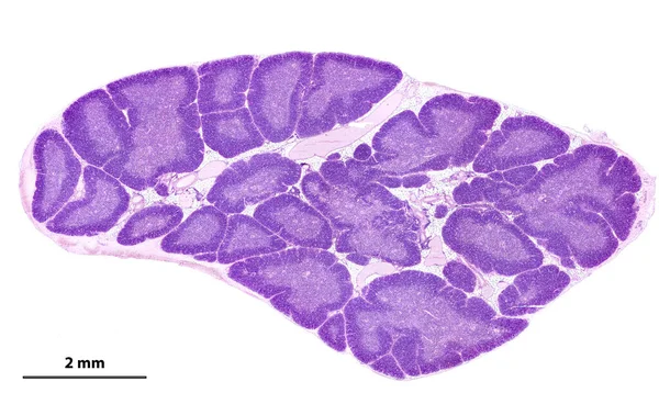 Heで染色されたヒト胸腺の低出力光顕微鏡顕微鏡顕微鏡 胸腺肉腫は 暗い末梢皮質と中央の透明な髄膜を示す脂肪組織によって区切られた小さな小葉で構成されています 末梢皮質が現れます — ストック写真