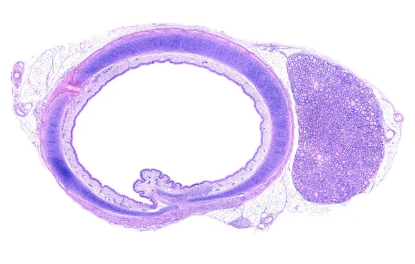 気管の断面の低出力光顕微鏡顕微鏡顕微鏡では ヒアリン軟骨のC字型の気管リングが示されている 気管粘膜は軟骨内に位置しています 甲状腺の右側の塊も見られます — ストック写真