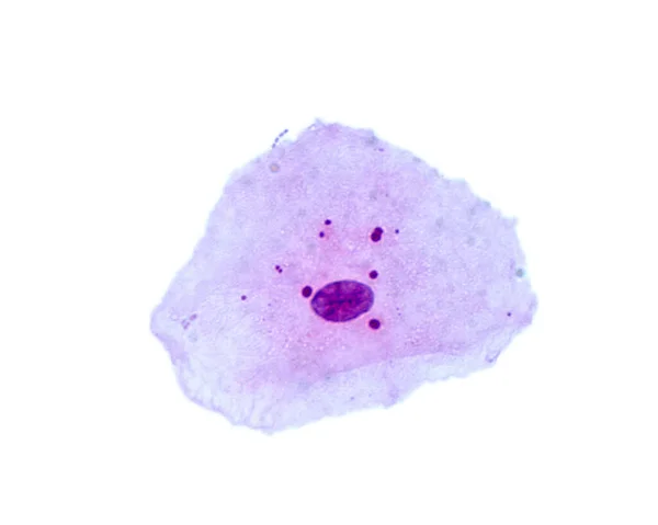Esfregaço Bucal Mostrando Células Escamosas Descamadas Das Mucosas Orais Pequenos — Fotografia de Stock