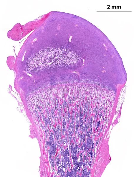 低功率光学显微镜 显示一个发育的长骨 在顶部 突触是由具有初始二次骨化中心的透明质软骨造成的 在底部 二级葡萄膜骨化中心 回合L — 图库照片