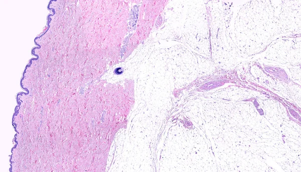 현미경의 사진은 왼쪽에서 오른쪽으로 보이고 Epdermis 두껍고 지역에 모낭이 보이고 — 스톡 사진