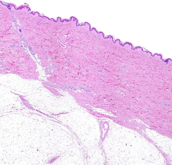 从上至下的薄皮肤 显示汗腺的非常厚的真皮和真皮下脂肪组织的低功率光学显微镜 血红蛋白 Eosin — 图库照片
