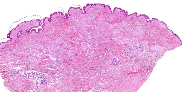 ヒト乳房乳首の低出力顕微鏡顕微鏡顕微鏡顕微鏡 それは色素性の薄い肌で覆われています 結合組織には平滑筋繊維 乳首の勃起 の多くのファクトリーがあります 下部には2つの汗 アポクリンとEcriがあります — ストック写真