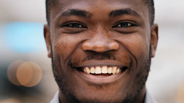 特写年轻自信快乐的非洲裔美国男性客户抬起头来看着相机笑着健康的牙齿笑着为诊所服务的男模高兴极了 — 图库照片