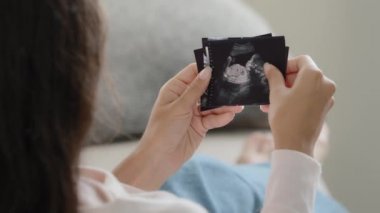 Back view future mom pregnant young fertile woman parent wife watching series ultrasound pictures of germ infant prenatal small embryo planning childbirth after vitro fertilization enjoying motherhood