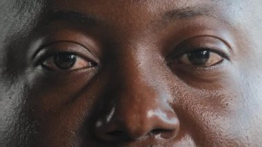 Close up male eyes body part face in detail african american adult sick sad man guy with dark skin client of ophthalmology has unhealthy tired eyesight red iris bad vision problem after computer work