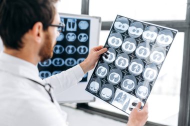 Röntgen çalışması. Dolabındaki röntgene odaklanmış zeki doktor beyaz üniformalı beyaz erkek terapist ve gözlüklü konsantre hastaların röntgenlerini çekiyor.