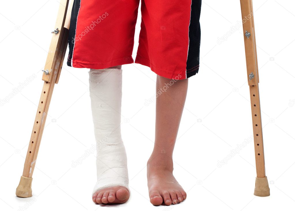 Leg fracture